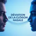 deviation cloison nasale avant apres illustration